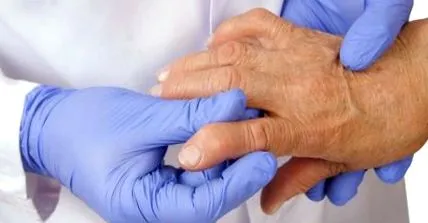 szeropozitív rheumatoid