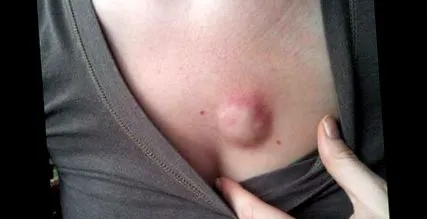 okok