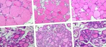 epithelialis epithelialis