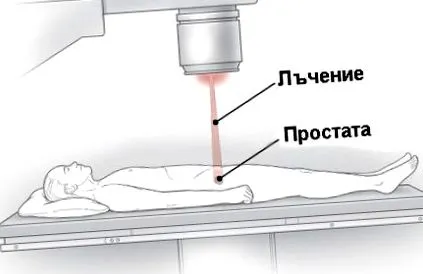 környező szöveteket