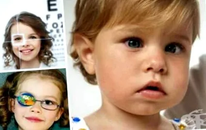 amblyopia lusta