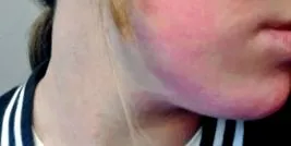 mira