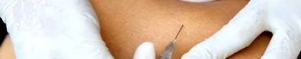 derma test