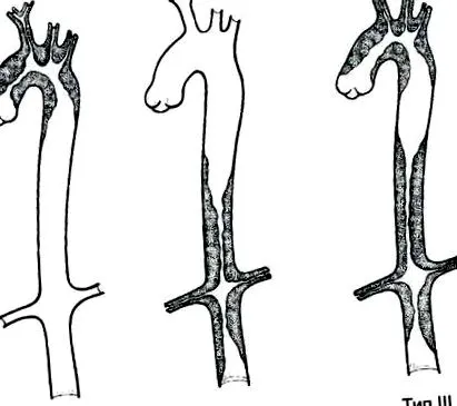 aorta specifikus