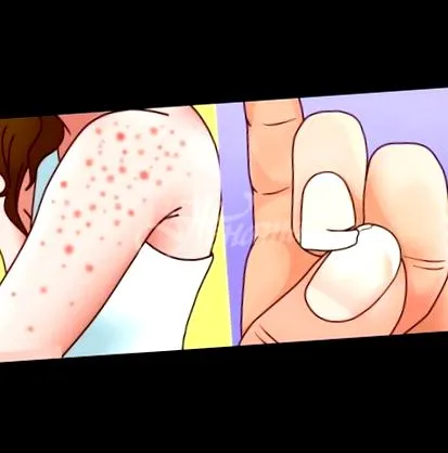 hívják