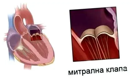 szelep szelep