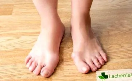 hallux lábujjműtét