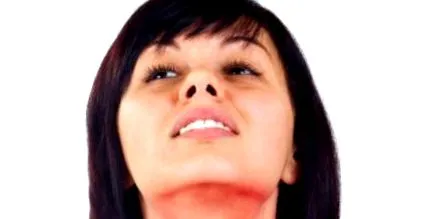 kezelése kezelése