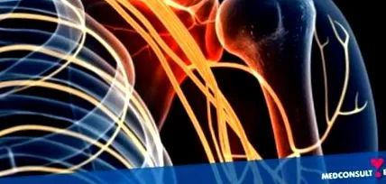 neuralgia neuralgia