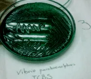 vibrio mikrobiológia