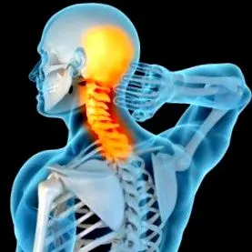 lordosis nyaki