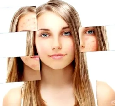 dermatosis