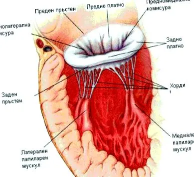 prolapsus mitralis