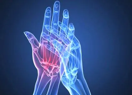arthritis tesztek