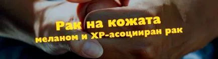 bőrrák melanoma kialakulásának