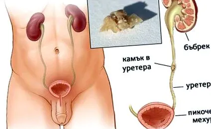 számára betegség