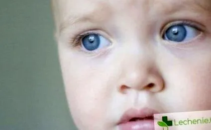 allergiás reakció allergiás reakció