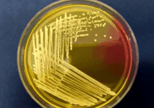staphylococcus aureus