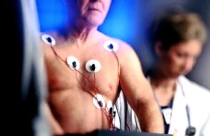 carotis stroke-okhoz
