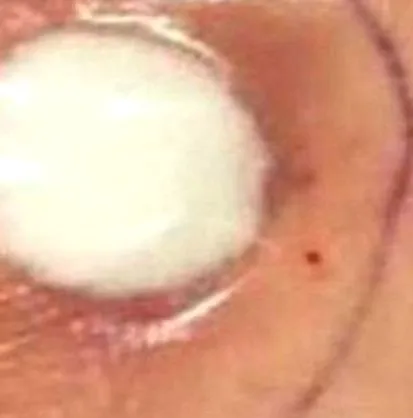tampont tampont