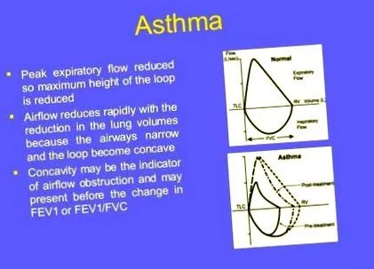 asztma asztma