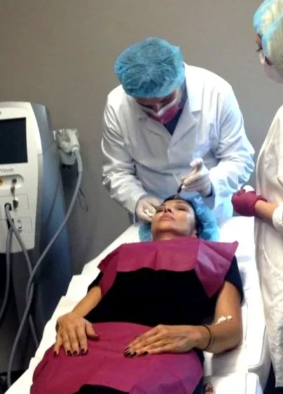 Vampire Facelift vámpíremelés
