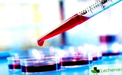 thrombocytopenia okok