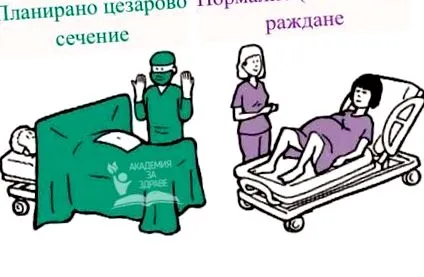 császármetszés vagy