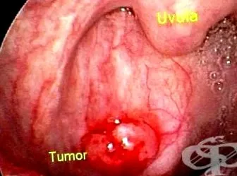 fala