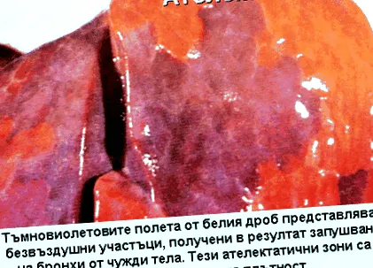 fojtogató fojtogató