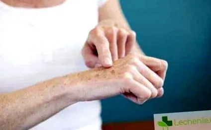 epidermisz felső