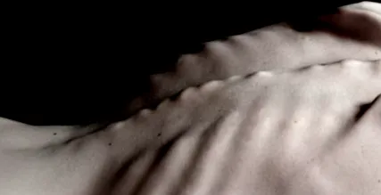 anorexiás 2500