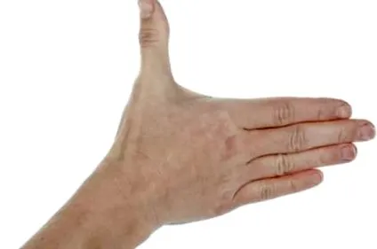 gyakorlat tendovaginitisére