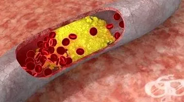 szerek antihyperlipidemic