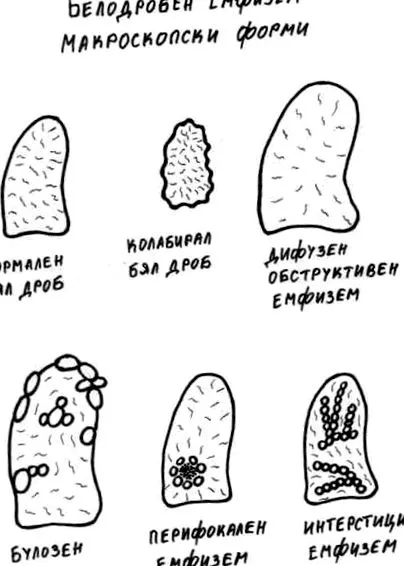 tünetei tünetei