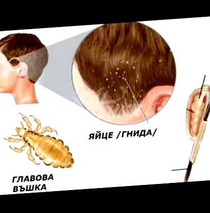 iskolákban kenet