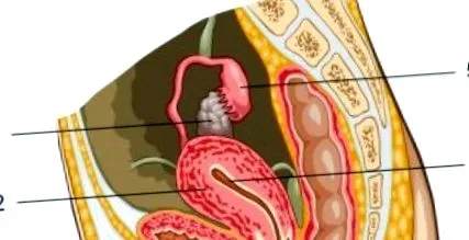 diabetes mellitus