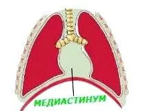 mediastinalis daganatok jóindulatú
