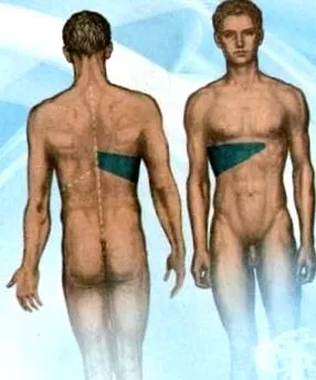 gócos noduláris