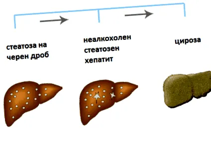 gyulladásos gyulladásos