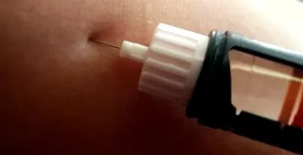 csökken cukorbetegek