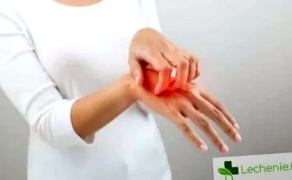 ekcéma ekcéma