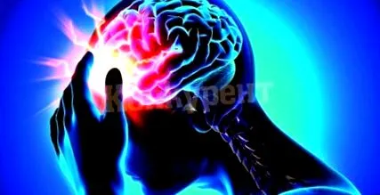 stroke kockázati