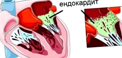 érintett meghatározása
