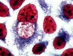 férfiaknál chlamydia