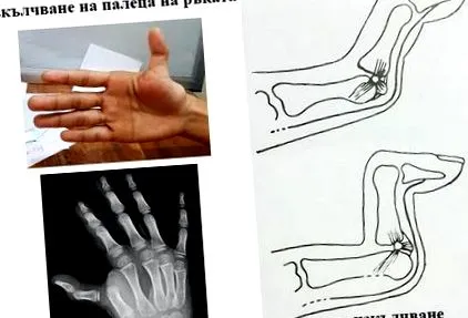 elmozdulása elmozdulása