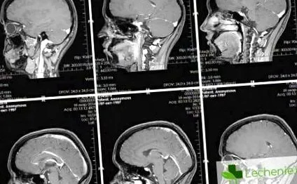 mágneses rezonancia képalkotás mágneses rezonancia képalkotás