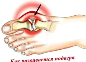 hogyan nélkül