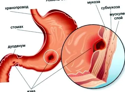 felismerni hogyan