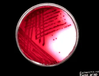 Escherichia coli